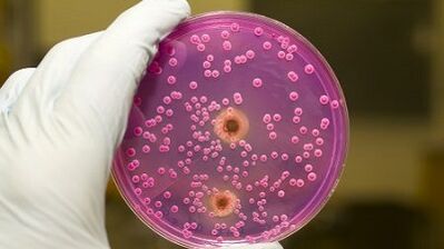 التفريغ المرضي عند الرجال عندما يكونون متحمسين