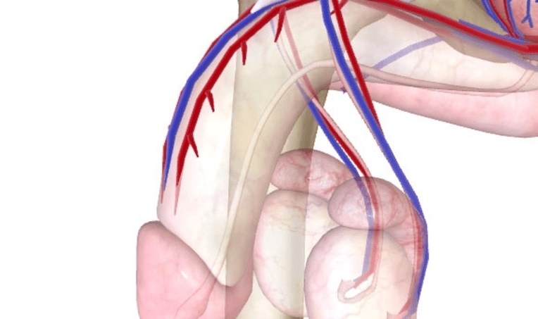 ضعف إمدادات الدم إلى القضيب